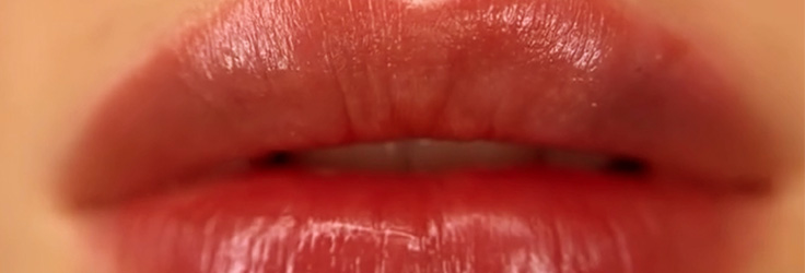 Modelowanie ust kwasem hialuronowym – Turowska Clinic Kleczew