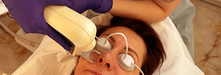 Laserowa redukcja popękanych naczynek QuadroStar – Turowska Clinic