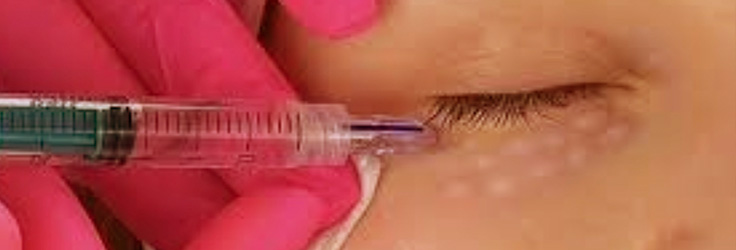 Tropokolagen – biostymulacja skóry, Turowska Clinic Kleczew