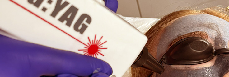 Peeling węglowy Black Doll Carbon Peel – Turowska Clinic Kleczew